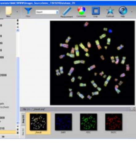 染色體熒光原位雜交軟件
